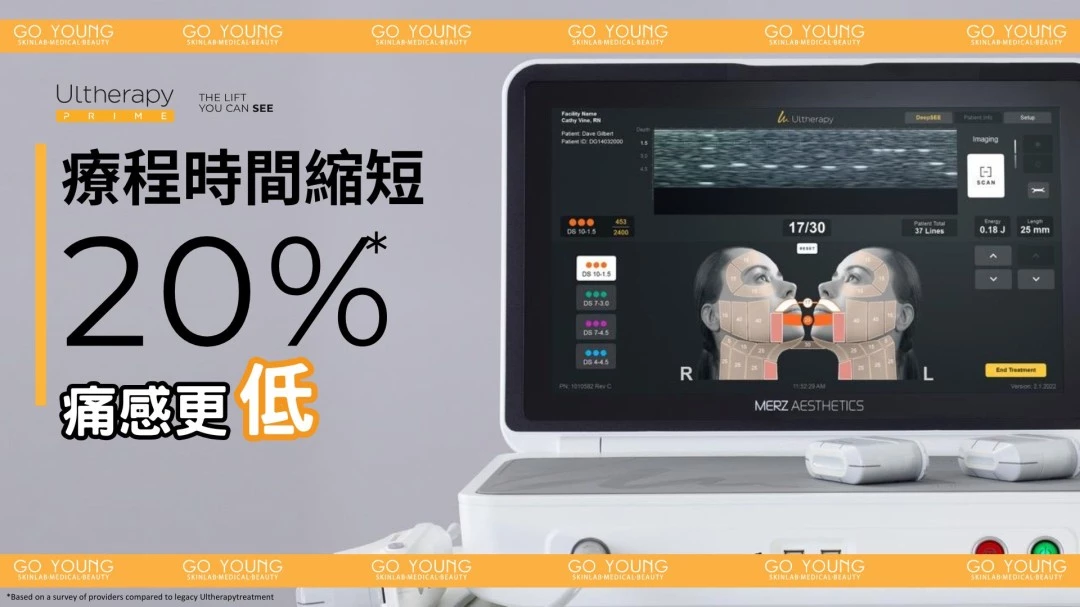 醫生主理 | Ultherapy PRIME® HIFU 二代 超聲刀療程