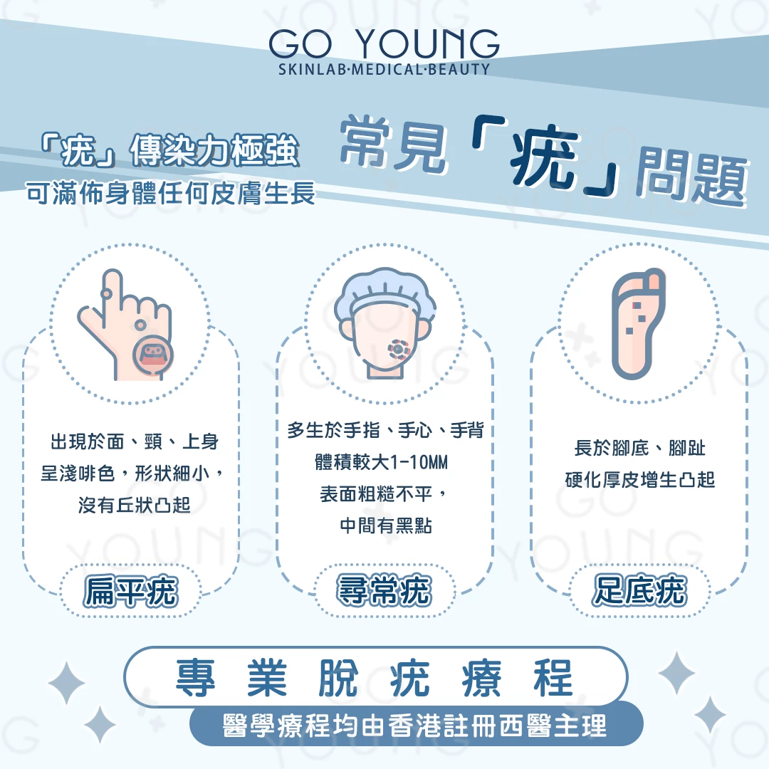 醫生主理 | 脫疣療程