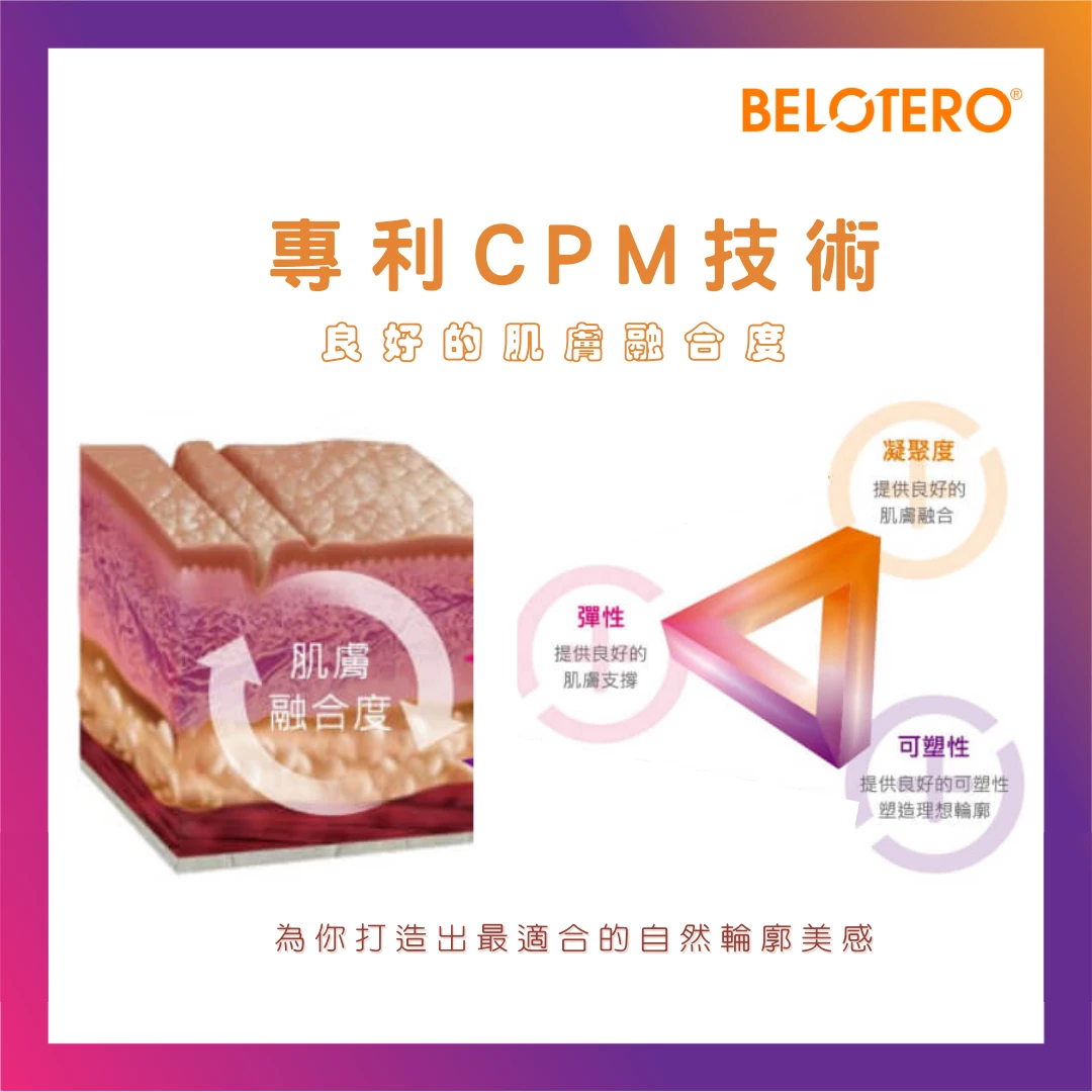 Belotero Soft