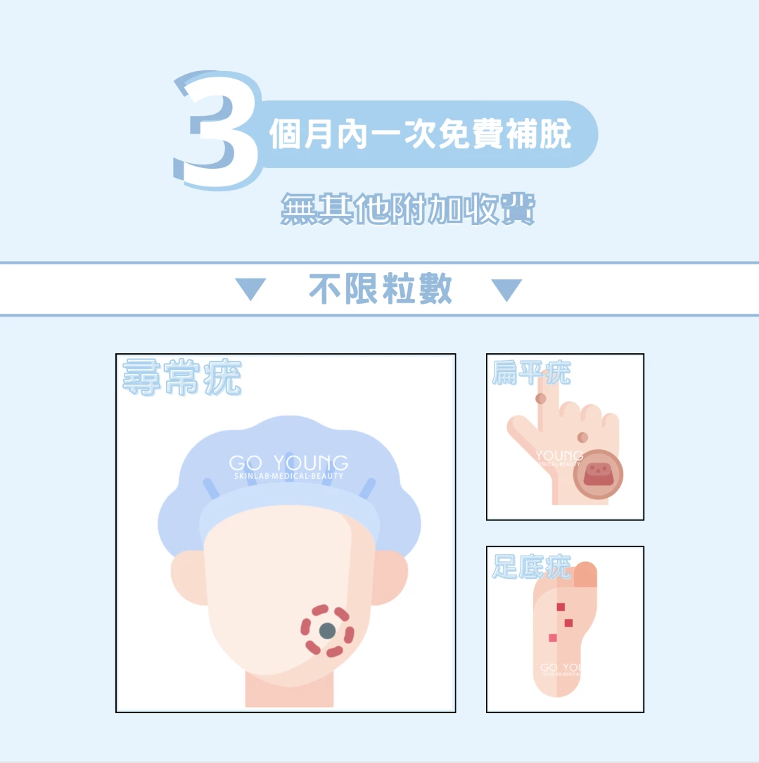 醫生主理 | 脫疣療程