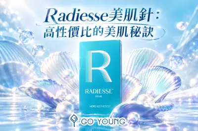 Radiesse美肌針：高性價比的美肌秘訣 - Go Young
