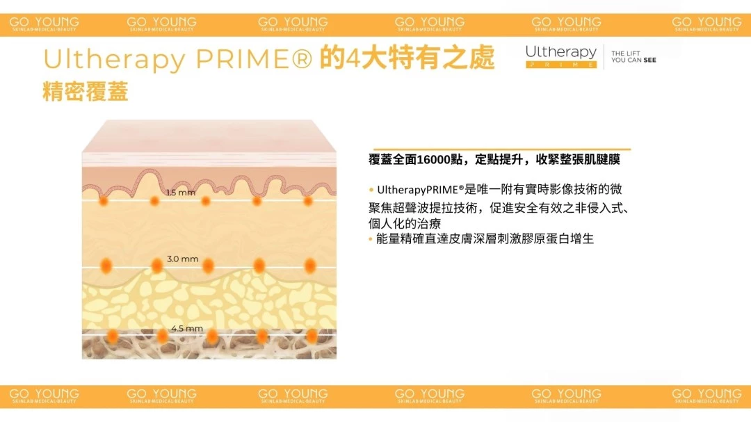 醫生主理 | Ultherapy PRIME® HIFU 二代 超聲刀療程
