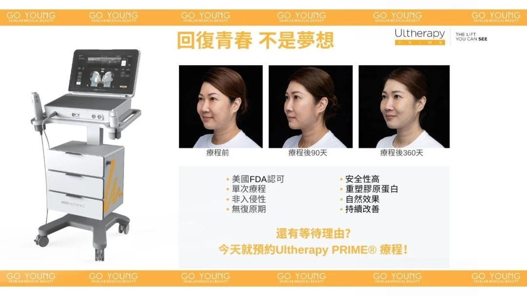 醫生主理 | Ultherapy PRIME® HIFU 二代 超聲刀療程