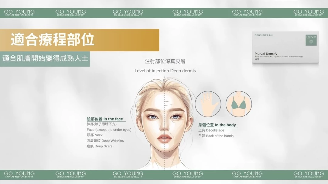 PLURYAL® DENSIFY 濾鏡針-緻柔針