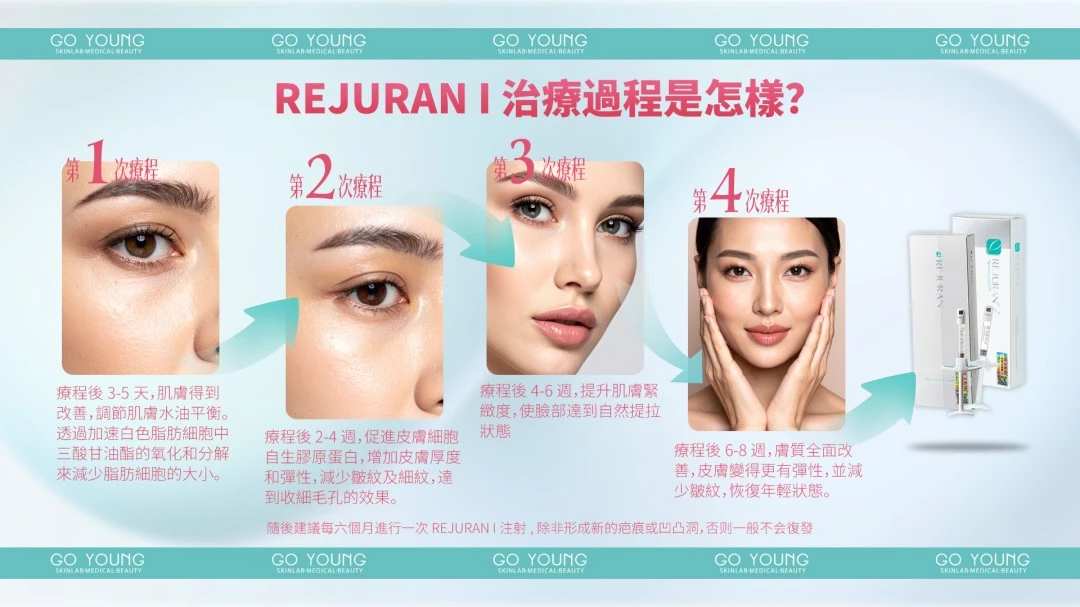 Rejuran® 麗珠蘭小白盒
