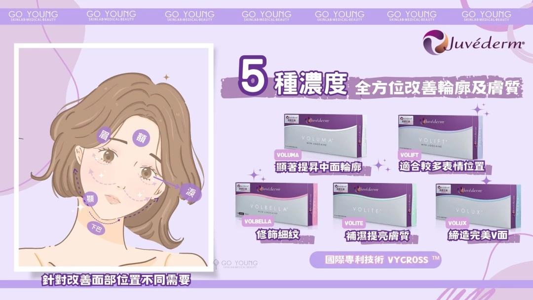 JUVÉDERM® VOLIFT（緹顏）