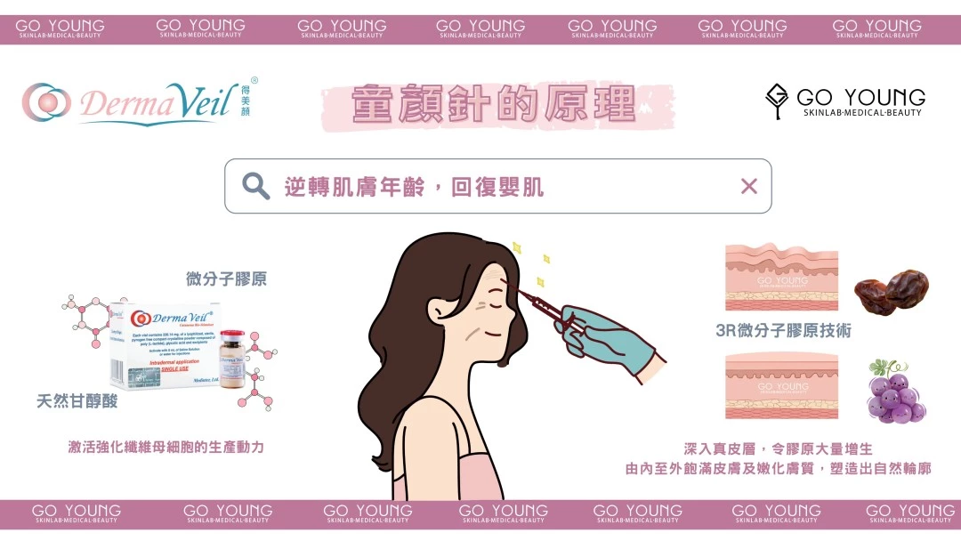 Derma Veil®童顏針