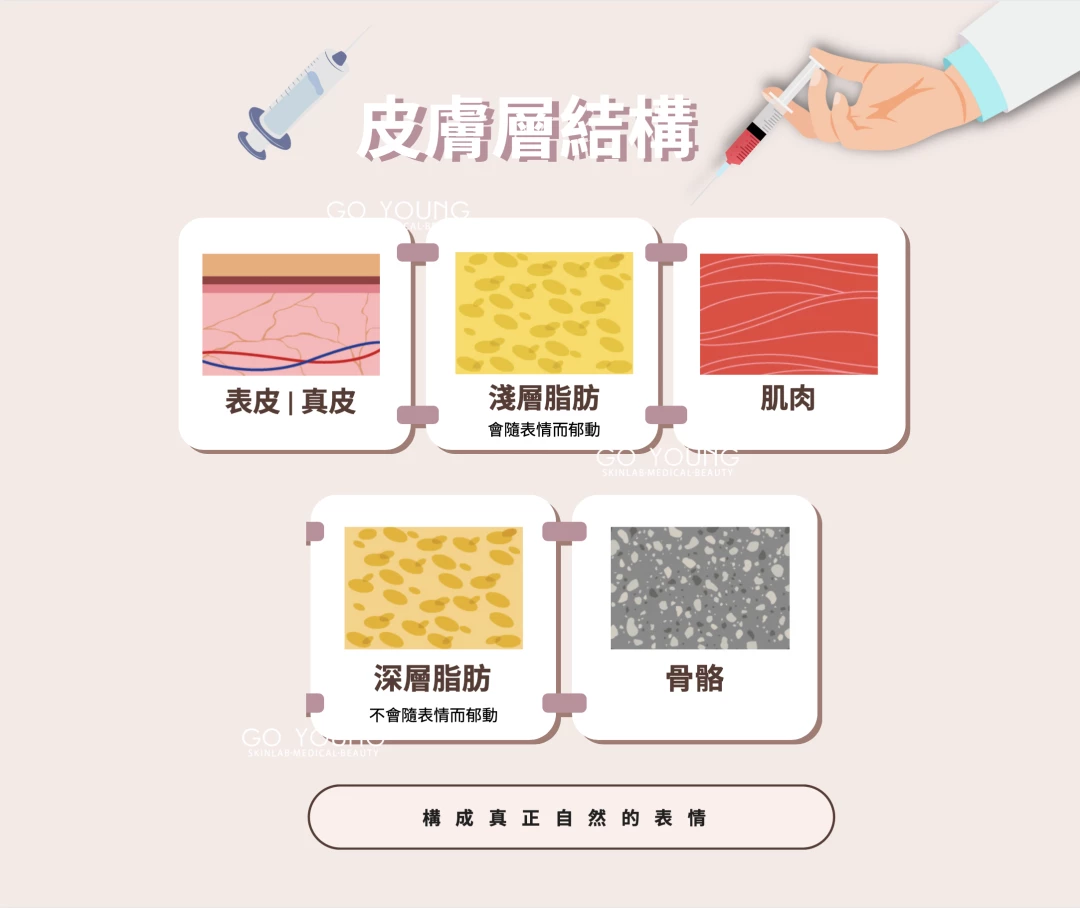 TEOXANE RHA® 2 彈性透明質酸