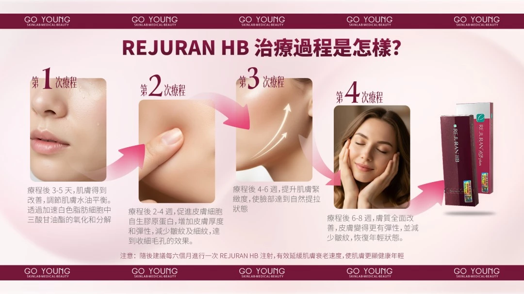 Rejuran® 麗珠蘭HB紅盒