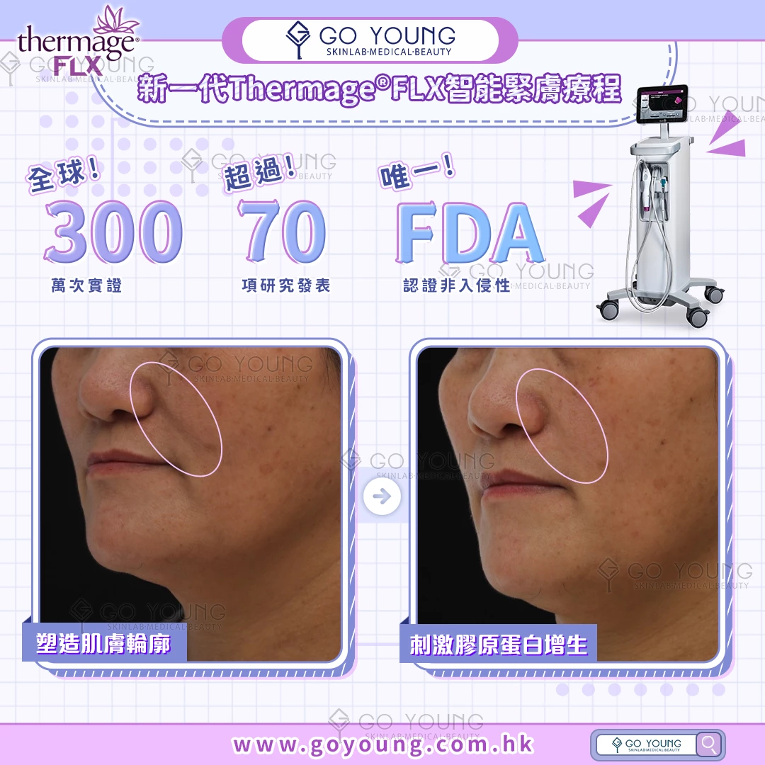 醫生主理 | Thermage® FLX （眼部）