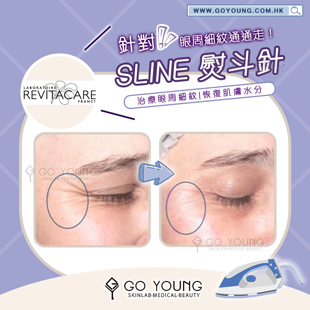 CYTOCARE S Line熨斗針
