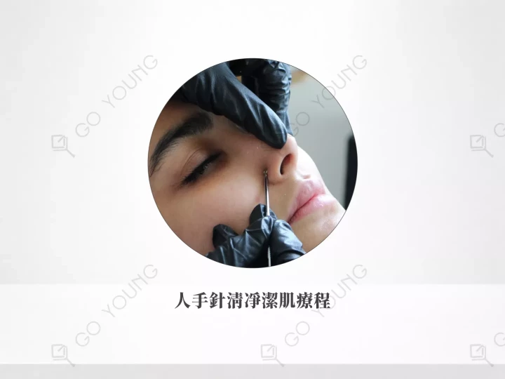 人手針清凈潔肌療程