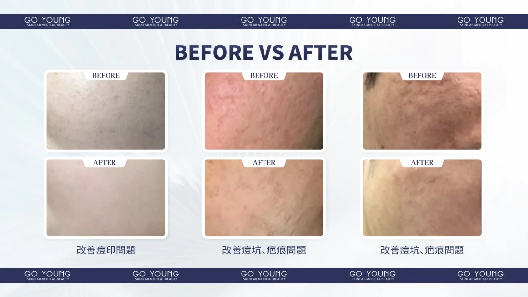 Rejuran® 麗珠蘭小藍盒