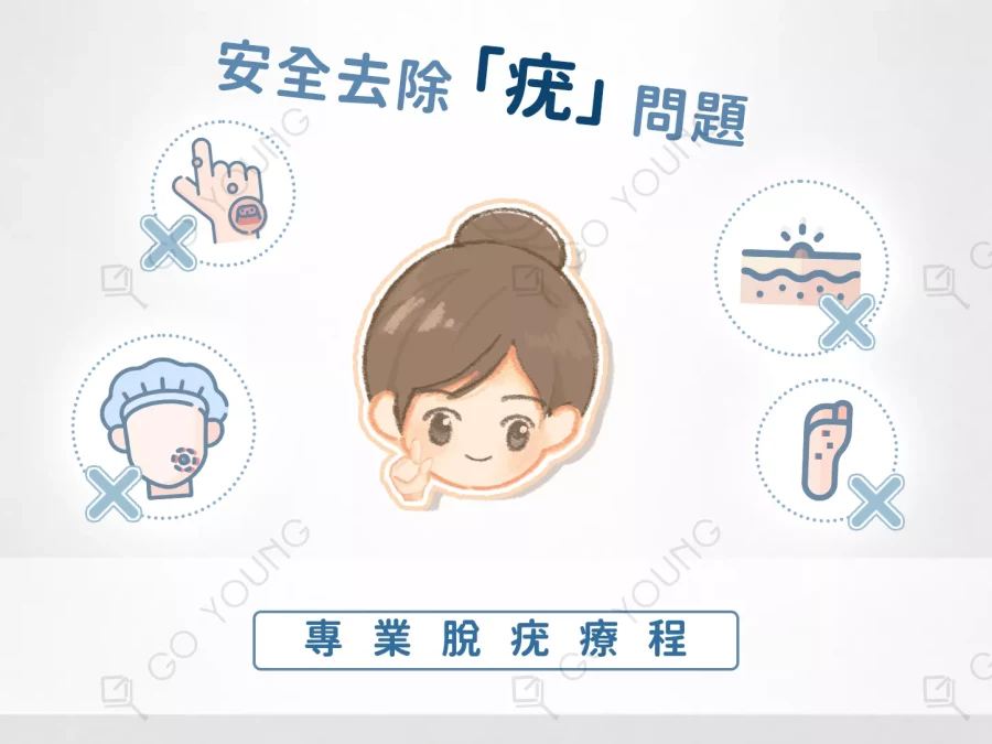 治療師｜脫疣療程
