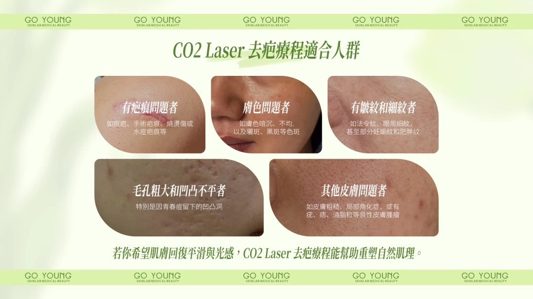 Co2 Laser 去疤療程