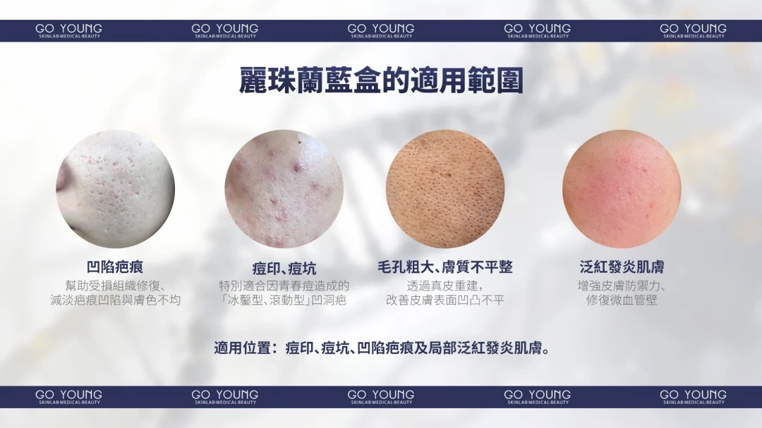 Rejuran® 麗珠蘭小藍盒