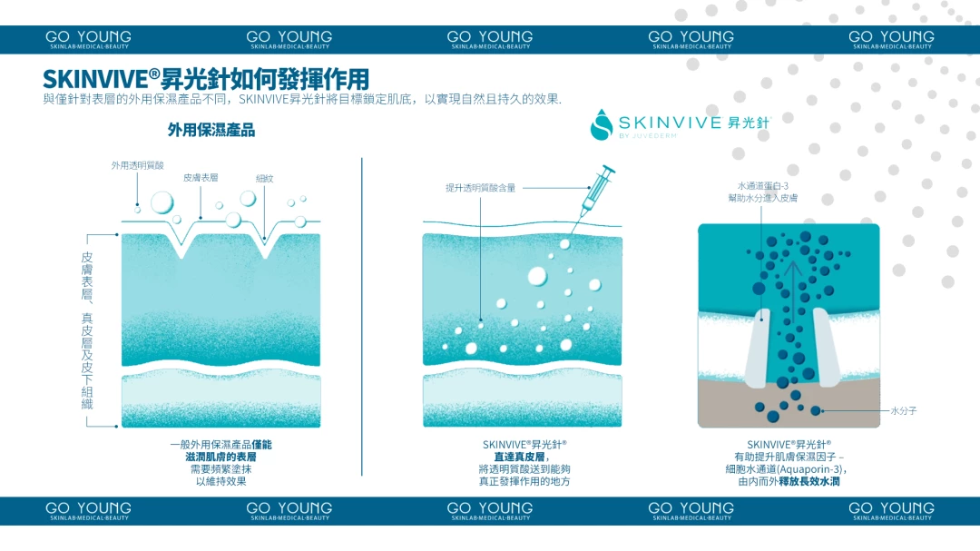 SKINVIVE®昇光針®