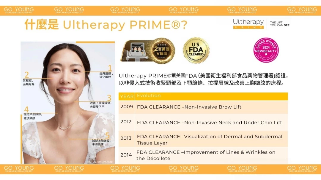 醫生主理 | Ultherapy PRIME® 二代 超聲刀療程