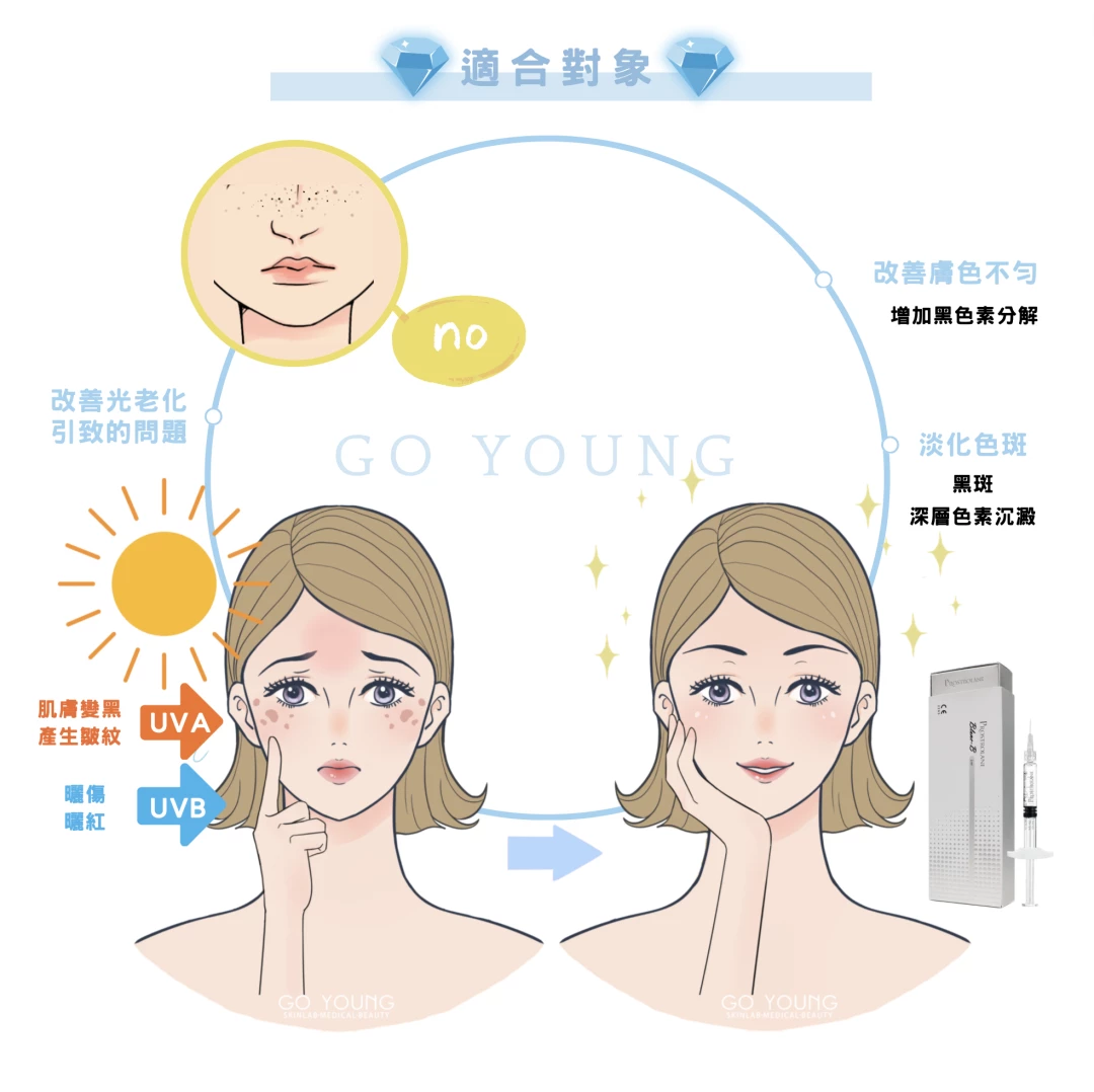 Blanc B 胜肽美白針