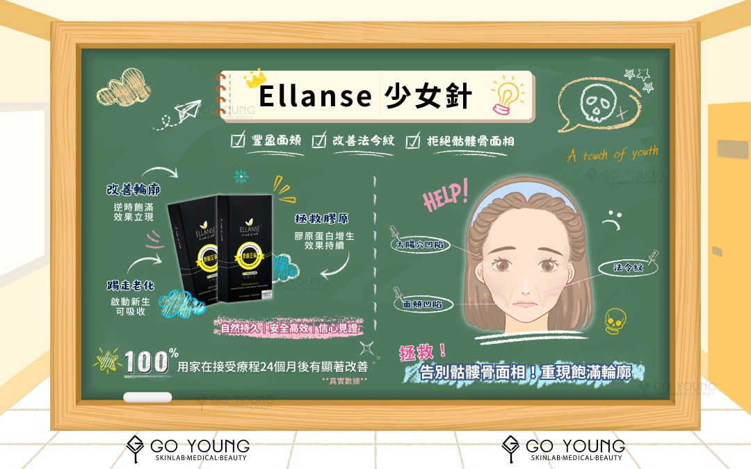 Ellanse M (少女針)