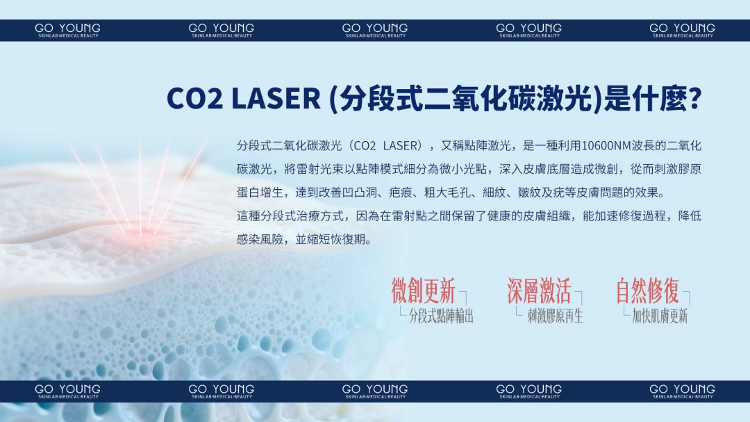 CO2 Laser 分段式二氧化碳激光療程