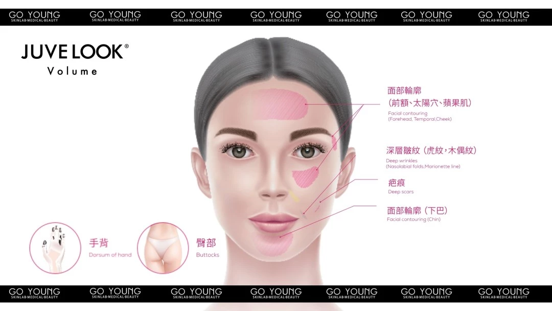 JUVELOOK Volume 塑顏針