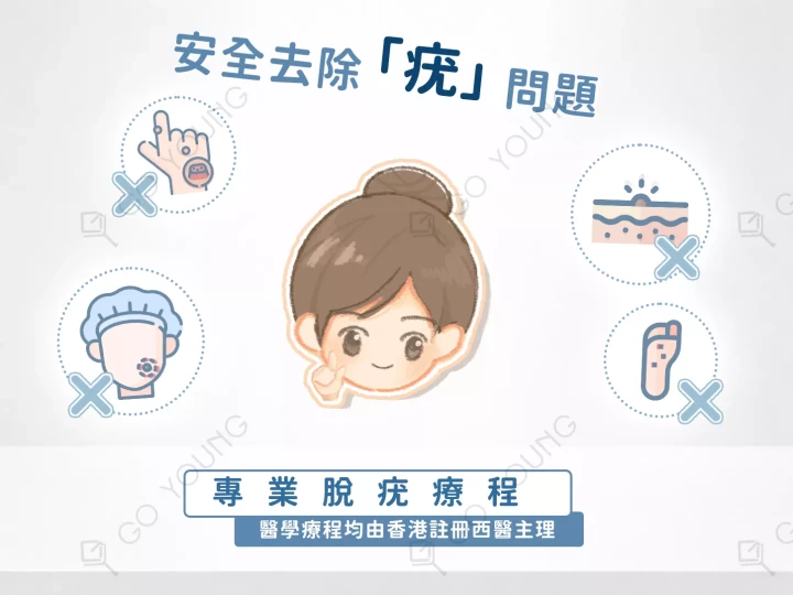 醫生主理 | 脫疣療程