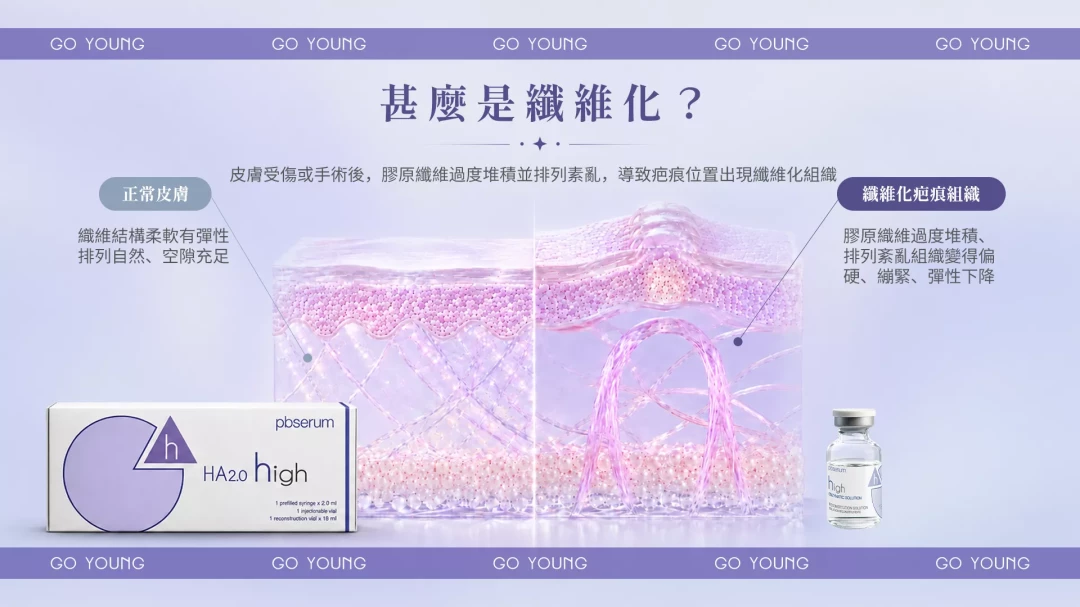 pbserum HA High