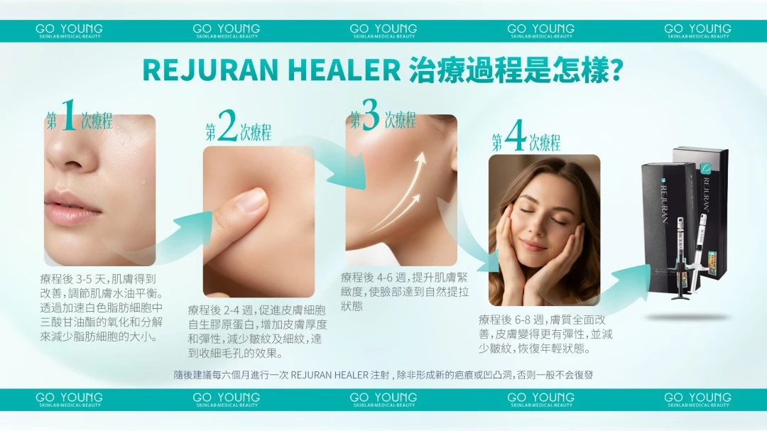 Rejuran® 麗珠蘭小黑盒