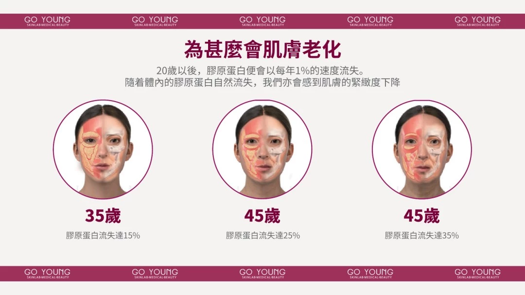 Sculptra 聚左旋乳酸-童顏針