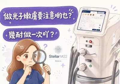 做光子嫩膚要注意啲乜？幾耐做一次吖？ - GO YOUNG