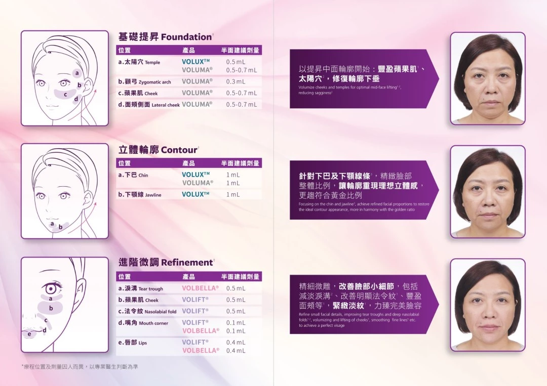 JUVÉDERM® VOLIFT（緹顏）