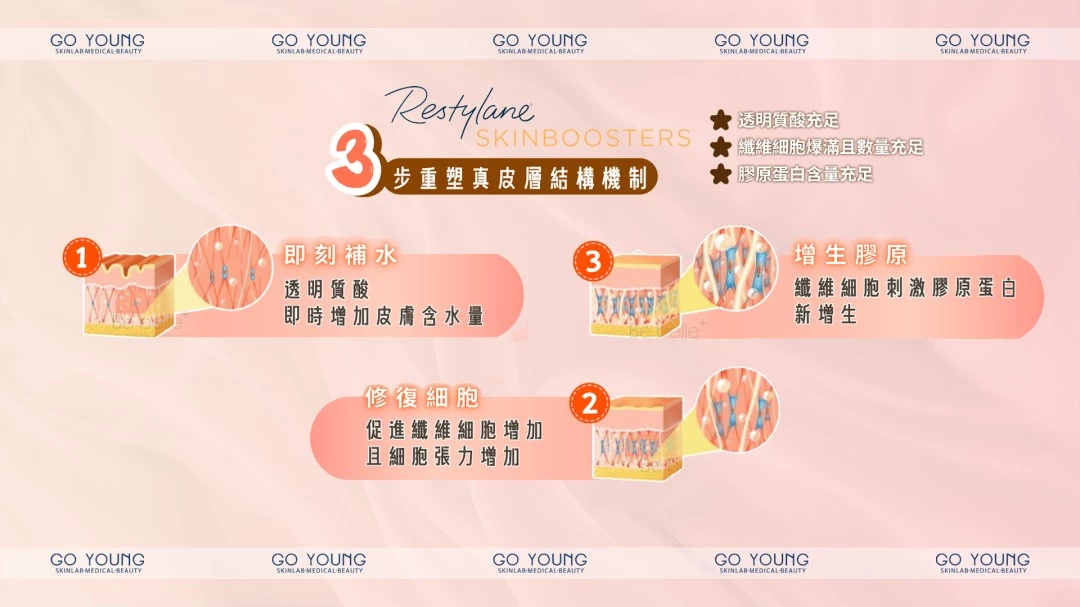 Restylane SKINBOOSTERS Vital Light®高效保濕針
