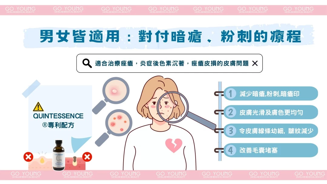 治療師主理｜Miami Peel®水楊酸煥膚療程