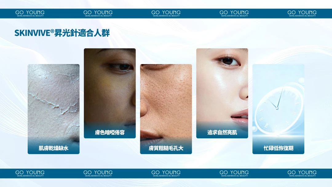 SKINVIVE®昇光針®