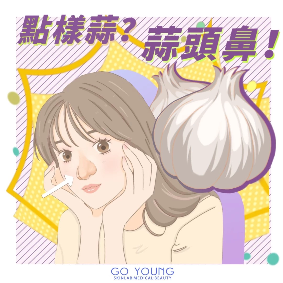 PDO 鼻埋線