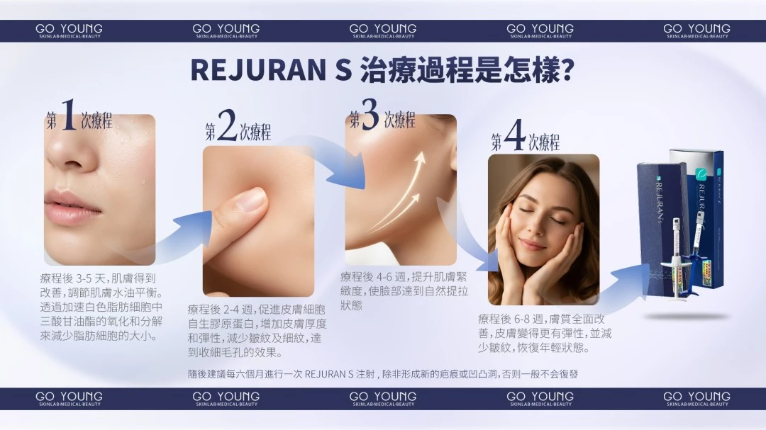 Rejuran® 麗珠蘭小藍盒