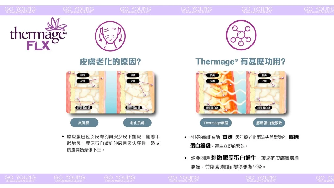 醫生主理 | Thermage® FLX （眼部）