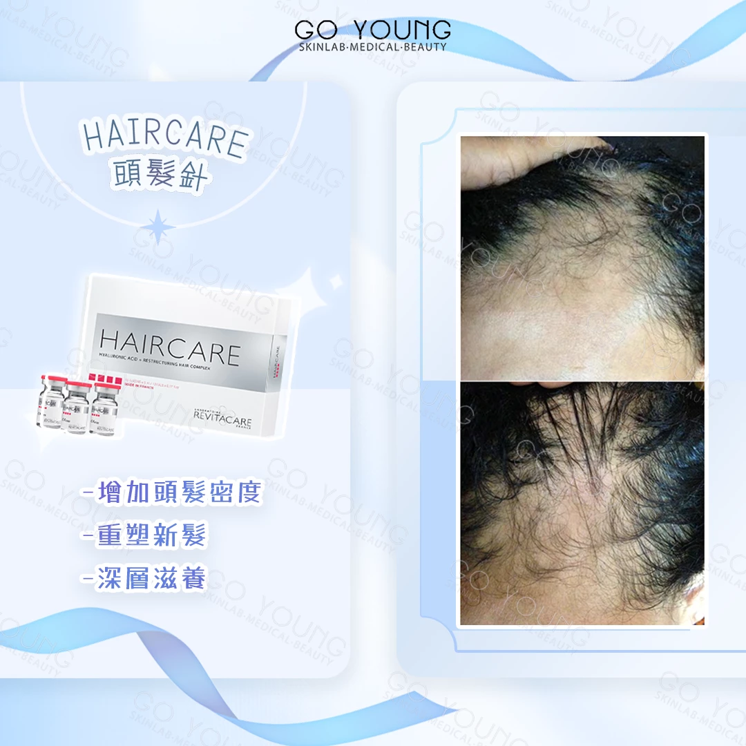 Haircare 小紅帽頭髮針
