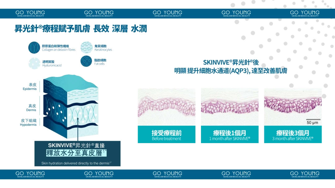 SKINVIVE®昇光針®