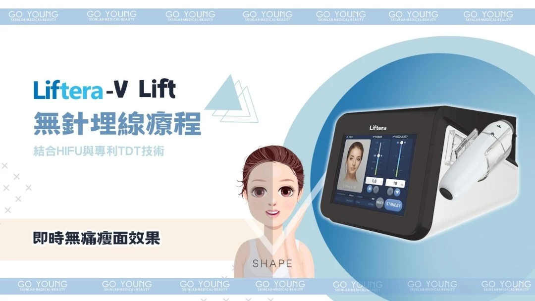 Liftera-V Lift 無針埋線療程