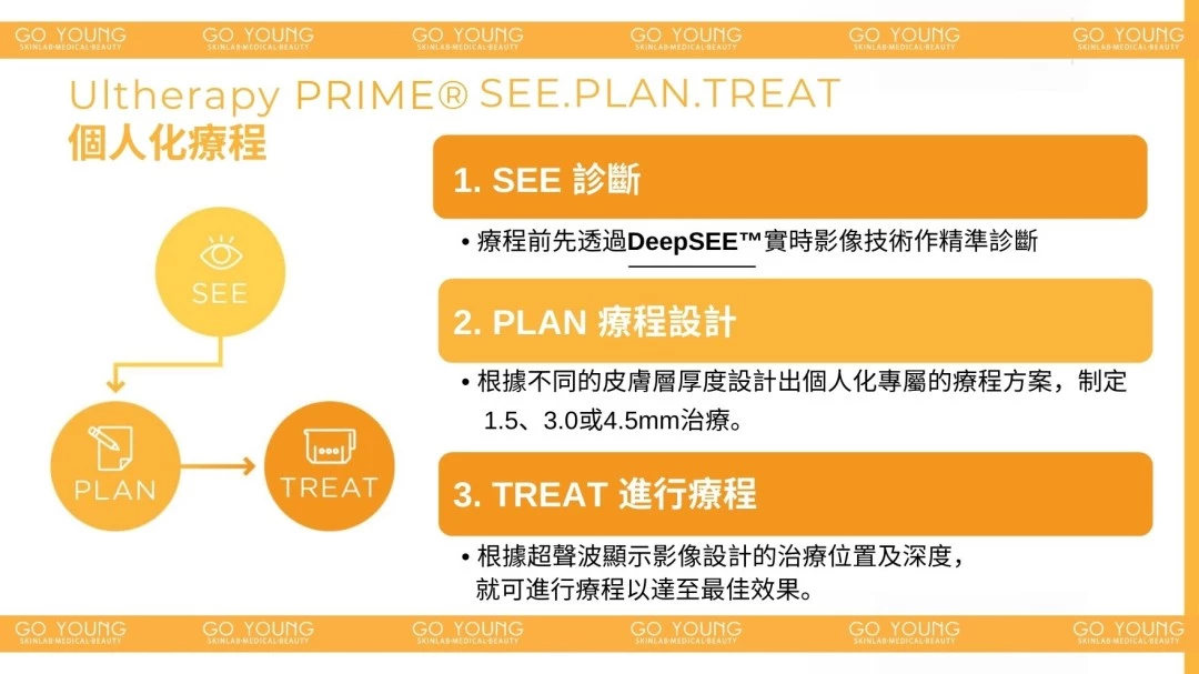醫生主理 | Ultherapy PRIME® HIFU 二代 超聲刀療程