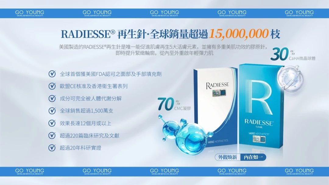 Radiesse 1.5cc + Belotero soft