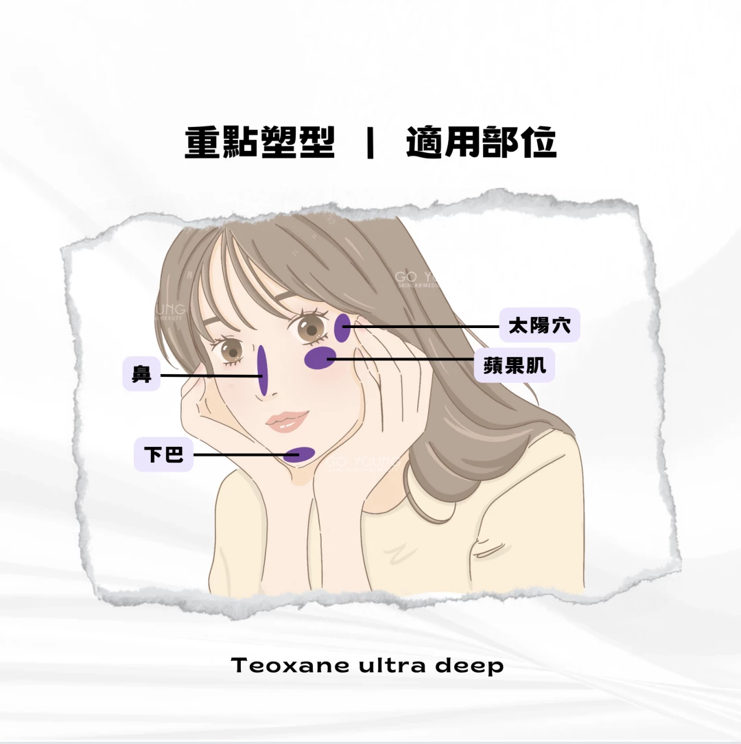 TEOXANE Ultra Deep