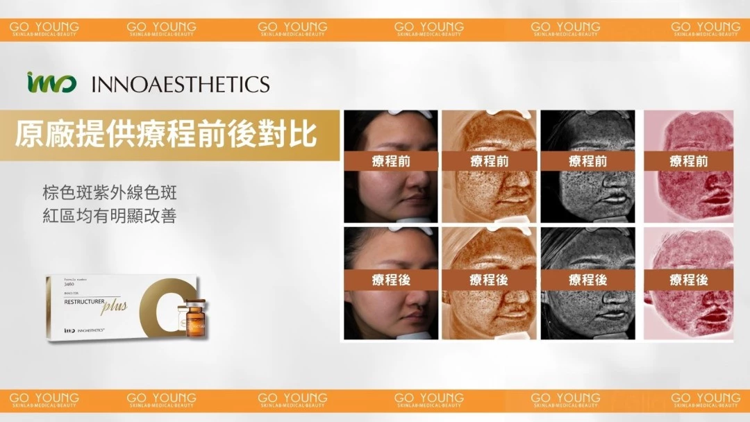 INNOAESTHETICS 英諾⼩棕瓶PLUS