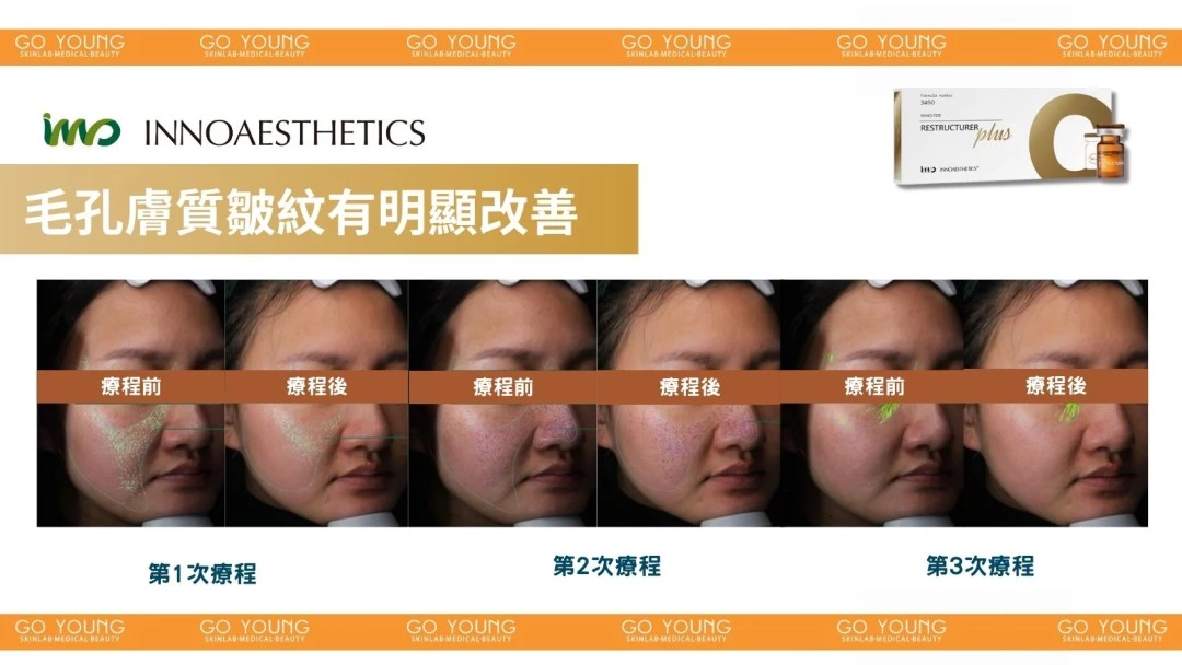 INNOAESTHETICS 英諾⼩棕瓶PLUS