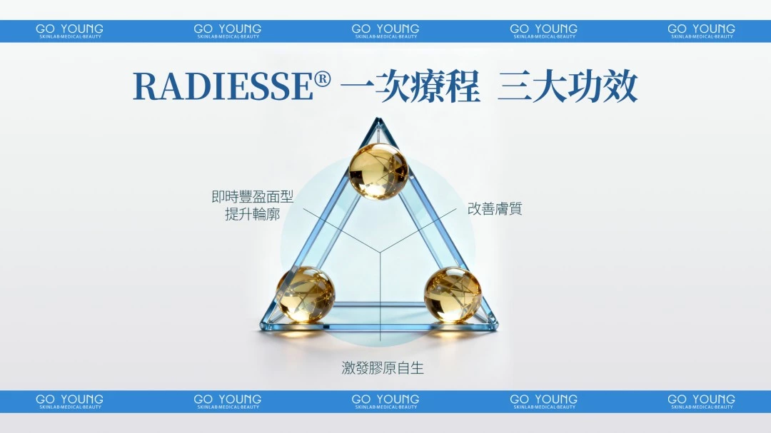 Radiesse 1.5cc + Belotero soft