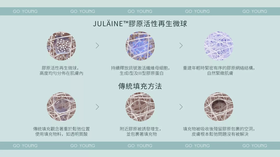 JULÄINE™ 膠原細面針