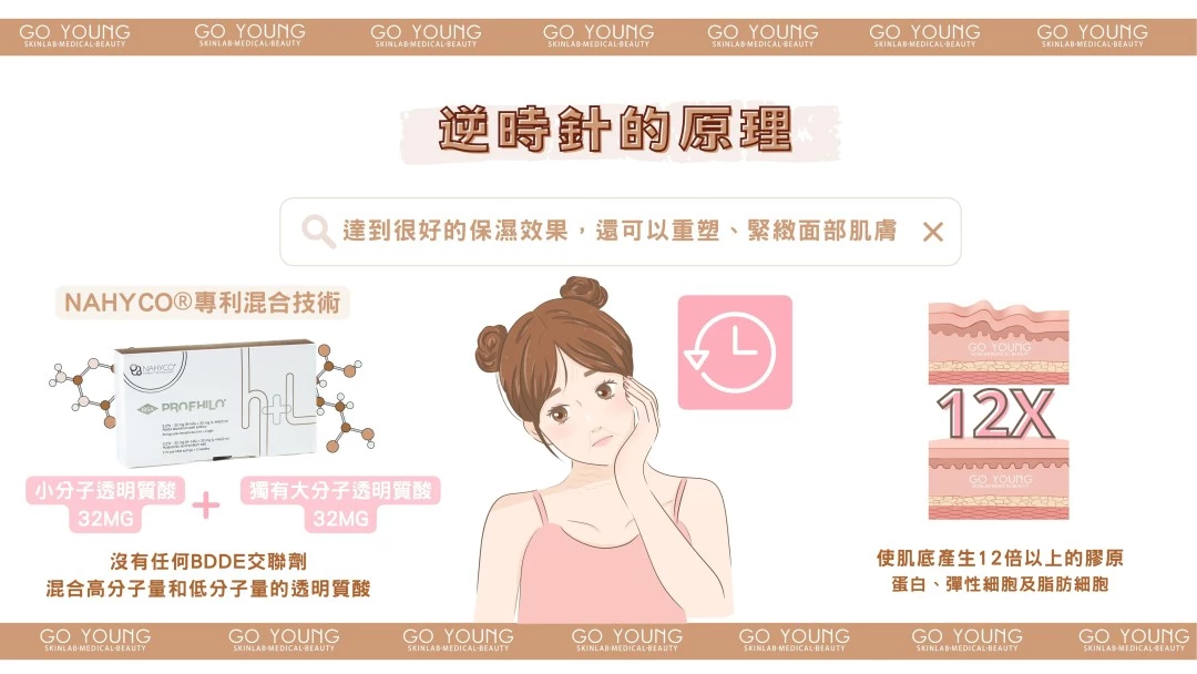 Profhilo 透明質酸逆時針