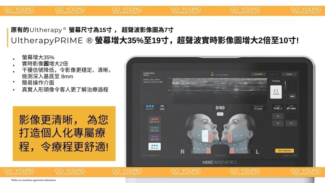 醫生主理 | Ultherapy PRIME® HIFU 二代 超聲刀療程